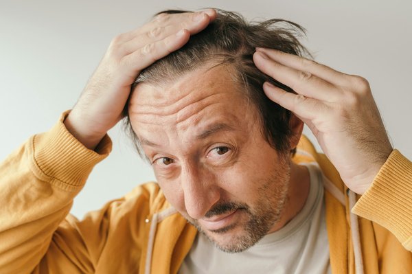 Conseils perte de cheveux homme : solutions efficaces et naturelles